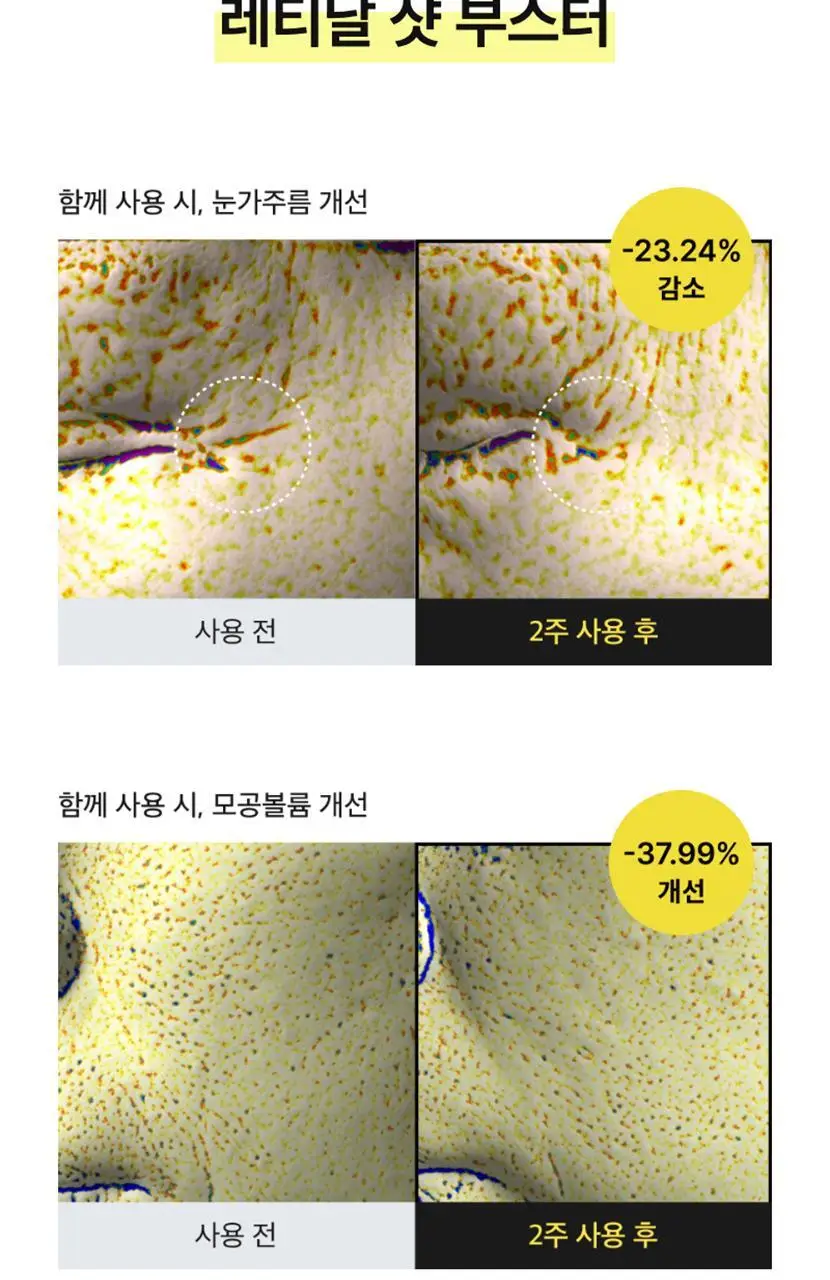 [모공탄력] 셀리맥스 더 비타 A 레티날 샷 타이트닝 부스터 15ml 상세페이지 43